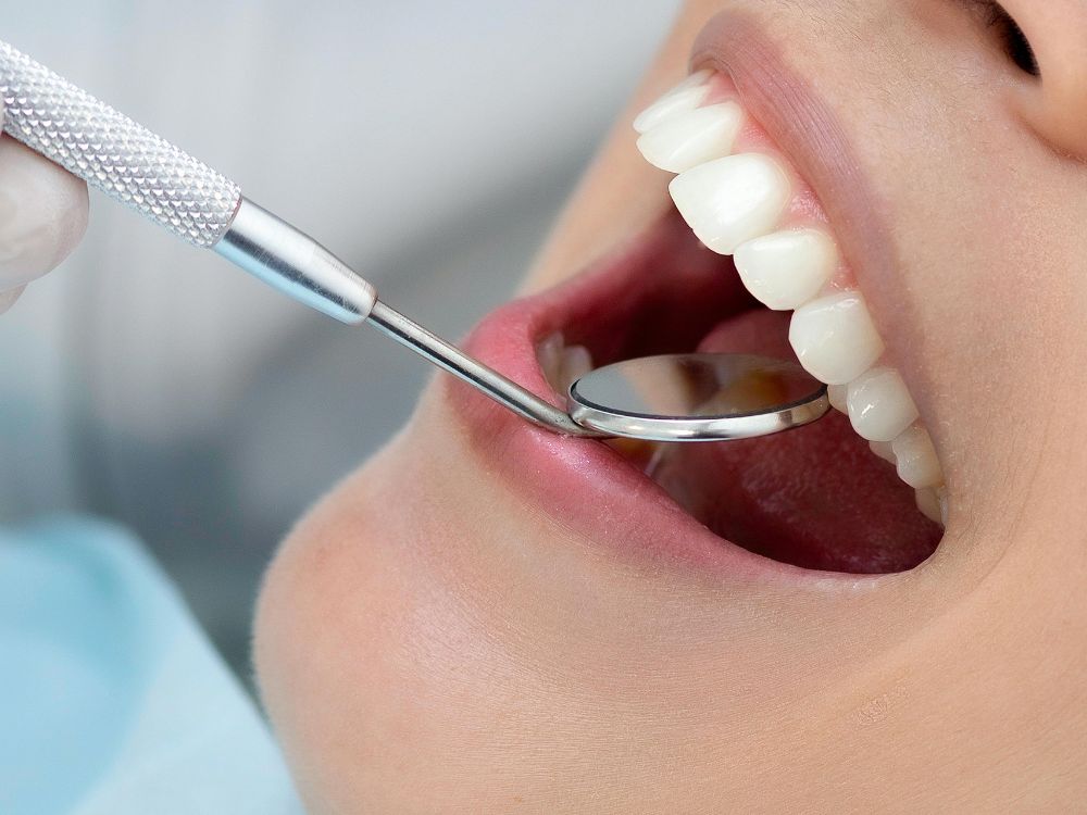 Dentista realizando exame clínico com espelho odontológico na boca de paciente para avaliação da saúde bucal e possível fratura dental.